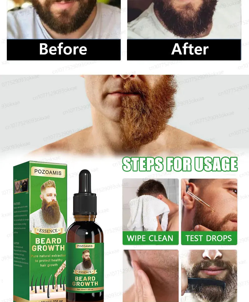 Sérum Croissance Barbe Homme – Barbe Plus Épaisse & Dense Rapidement | Anti Trous